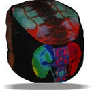 Kidney